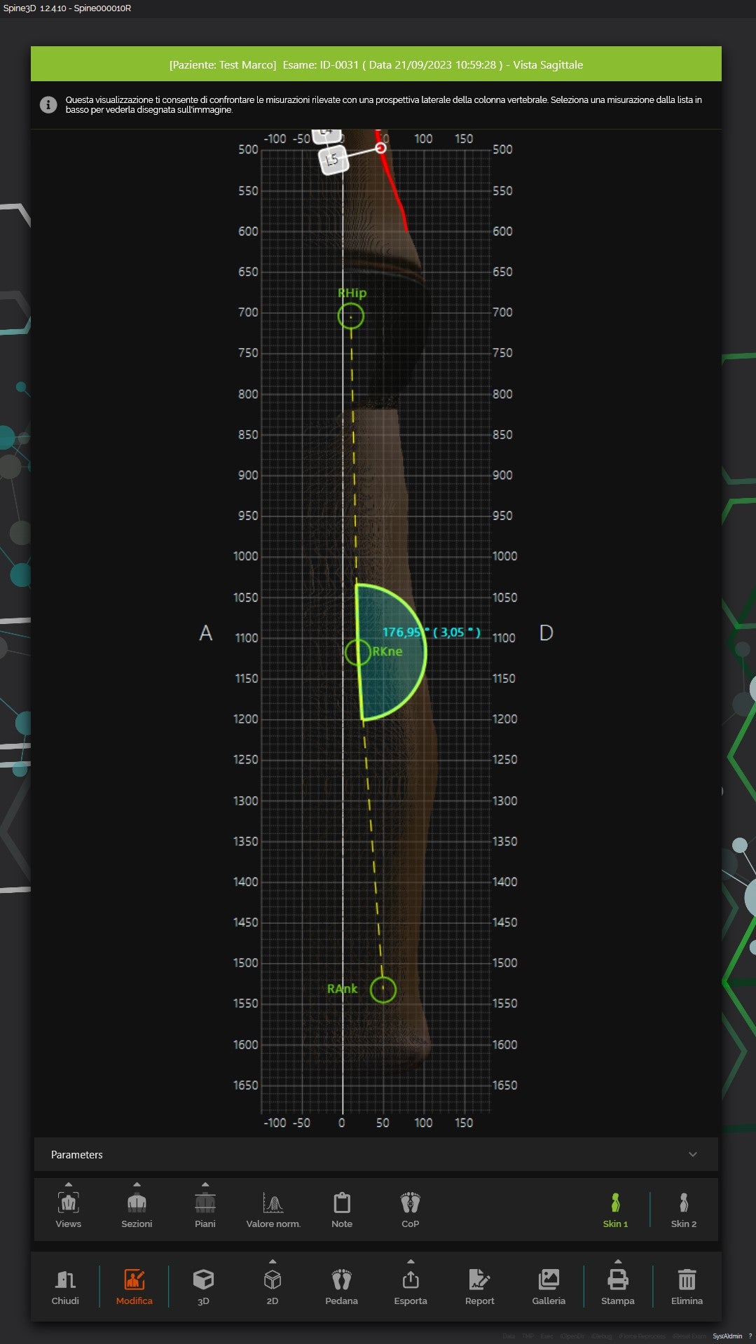 Foba Motion